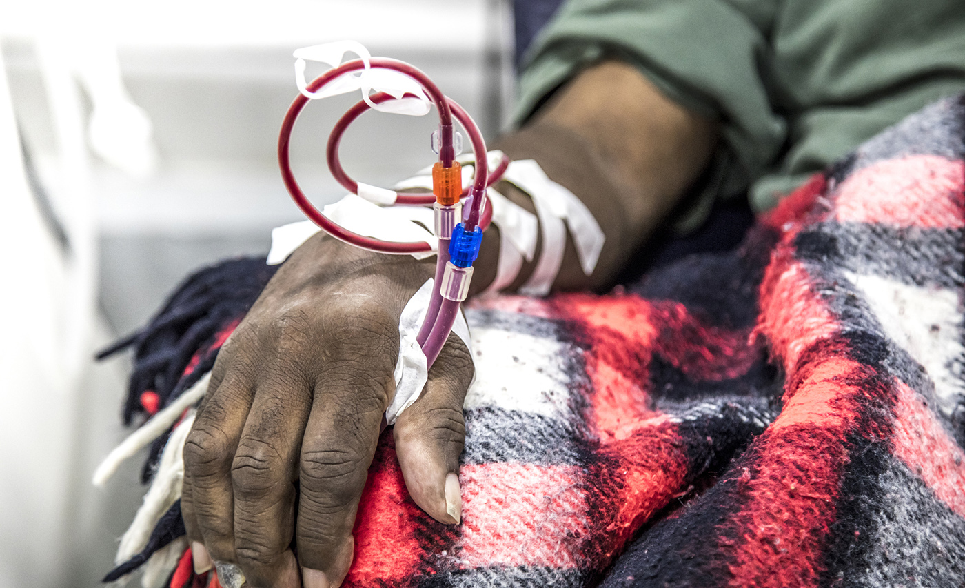 Close up of Black man's hand holding tubes used for kidney dialysis