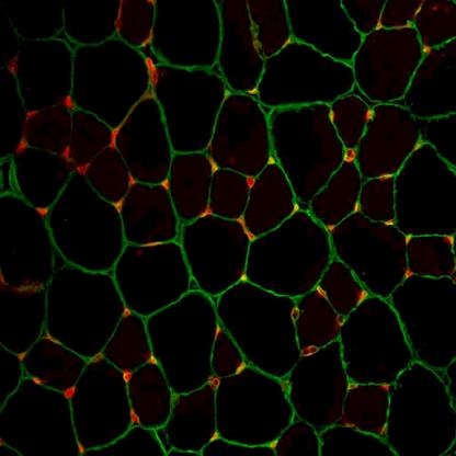Connection of cells
