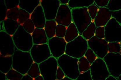 Greenish orangey cell structures against black background