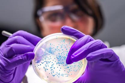 Researcher looking at petri dish of samples