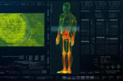 Digital medical scan showing a human body with highlighted joints and internal areas.