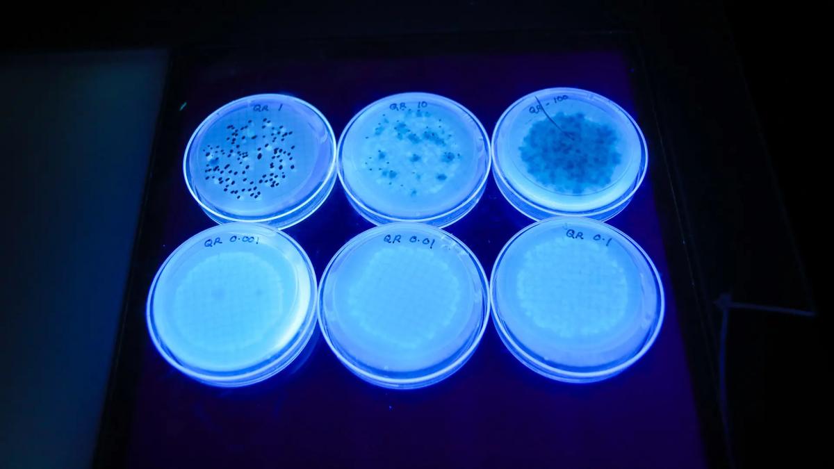 Bacterial colonys on agar plate from Anacostia samples