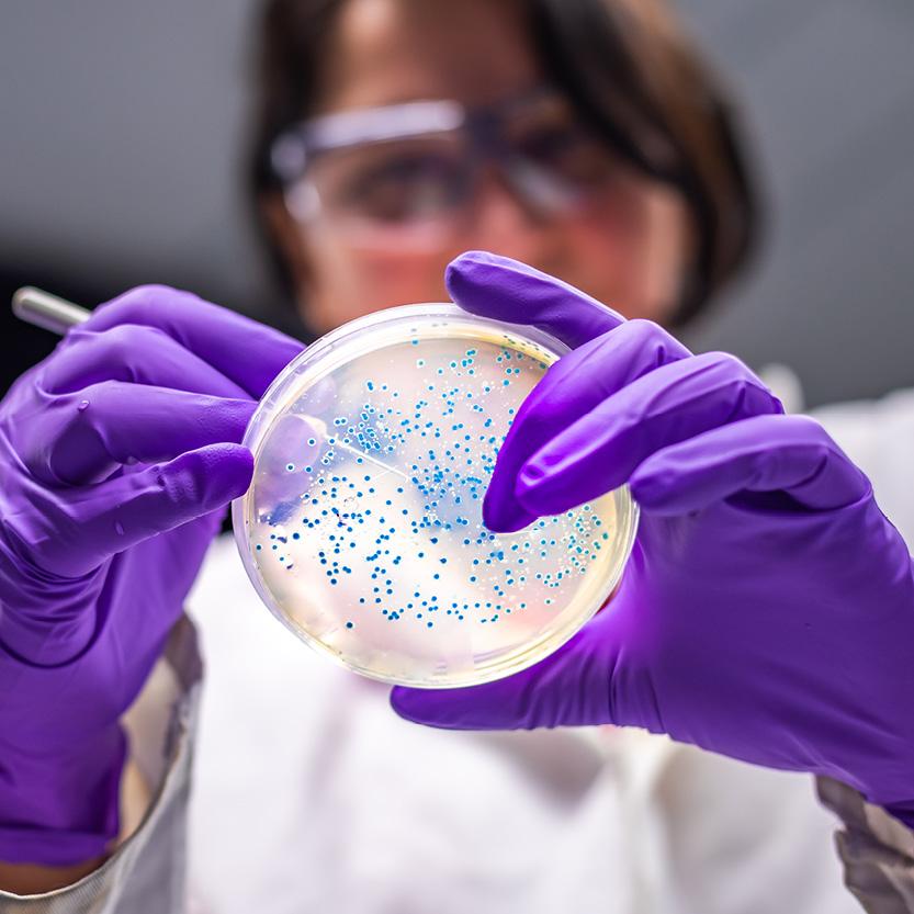 Woman researcher performing examination of bacterial culture plate